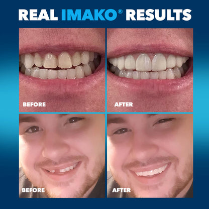 Imako® Cosmetic Teeth – Refill Kit