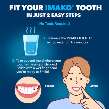 Imako® Tooth Tinted Plastic – Temporary Tooth – For Chipped Tooth & Fill Gaps in Teeth