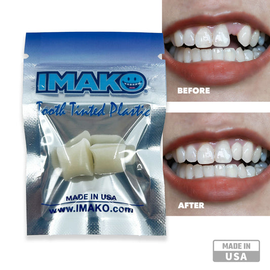 Imako® Tooth Tinted Plastic – Temporary Tooth – For Chipped Tooth & Fill Gaps in Teeth